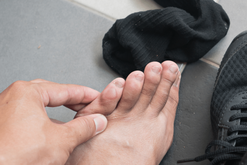 Suddenly getting blisters during your run is a sure sign it's time to replace your running socks.